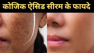 Kojic Acid Serum Benefits In Hindi [upl. by Hancock]