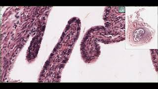 Histology of the Oviduct Fallopian Tubes 4K [upl. by Burr]