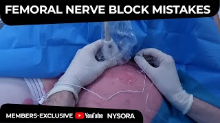 Femoral Nerve Block Common Mistakes  Crash course with Dr Hadzic [upl. by Ayirp]