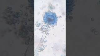 LPCB staining  Mycology  Fungi  Microbiology shorts youtube [upl. by Allerus437]