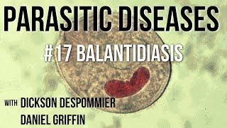 Parasitic Diseases Lectures 17 Balantidiasis [upl. by Onileva]