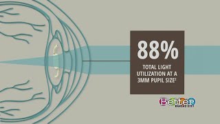 Trifocal lens could bring new options for cataract patients [upl. by Humfried]