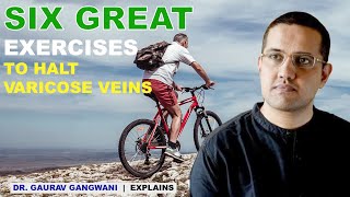 Best exercise for varicose veins  Varicose veins treatment  Dr Gaurav Gangwani [upl. by Schnur206]