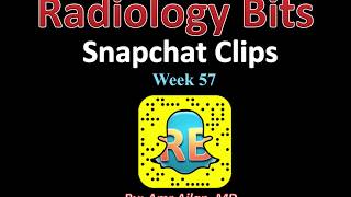 RADIOLOGY BITS SNAPCHAT WEEK 57 [upl. by Oicatsana526]