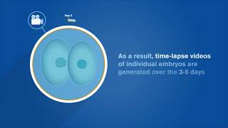 EmbryoScope® How Timelapse Works [upl. by Cayser742]