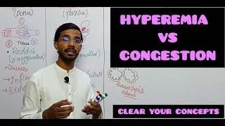 HYPEREMIA VS CONGESTION medicalpathologyhyperemiacongestion [upl. by Anderson]