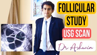 Follicular Study Explained  Ultrasound Scan Ovulation Malayalam Video Dr Ashwin Jayakrishnan [upl. by Erodasi]