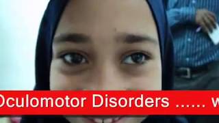 Intermittent Exotropia  الحول الوحشي المتقطع [upl. by Wie]