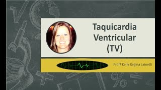 Taquicardia Ventricular TV [upl. by Gian]