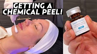 I Got a Chemical Peel My Experience With SkinCeuticals TCA Peel for Hyperpigmentation amp Melasma [upl. by Akela]