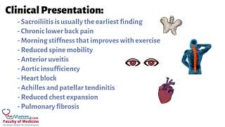 Ankylosing Spondylitis Summarized in 3 Minutes for HCPs Presentation  Diagnosis  Treatment [upl. by Morgana925]