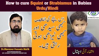 How to cure Squint or Strabismus in Babies  Urdu Hindi [upl. by Rexford]