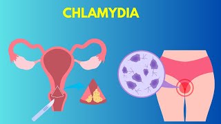 Signs and Symptoms of Chlamydia [upl. by Salesin208]