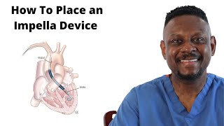 Impella Assist Device Placement [upl. by Kirshbaum]