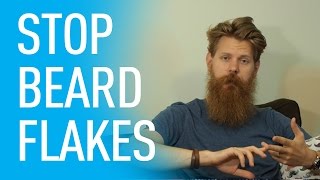 How To Stop Dandruff  Eric Bandholz [upl. by Edrahs]