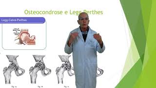 DrRenato Bastos  Osteocondrose [upl. by Marba251]