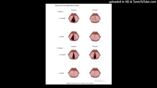 Endoscopic anteriorposterior cricoid split for pediatric bilateral vocal fold paralysis [upl. by Ayak]