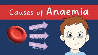 Anaemia causes microcytic normocytic macrocytic  MADE EASY [upl. by Eelhsa126]