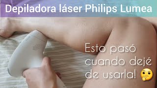 ★ Depiladora láser permanente IPL 999999 flashes de Beamia 😉 [upl. by Kwarteng871]