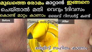 Facial hair കളയാൻ എളുപ്പവഴിhair removing natural homemade remedyലൈവ് റിസൾട്ട് കണ്ട് നിങ്ങൾ ഞെട്ടും [upl. by Nylirak]