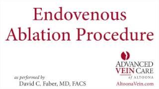 Endovenous Ablation Procedure [upl. by Aetnahs]