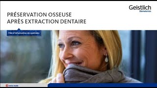 Extraction d’une dent – que faire maintenant [upl. by Eislehc140]