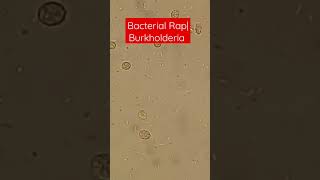 Bacterial Motility  Burkholderia in Rap Move [upl. by Klingel946]