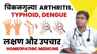 Chikungunya Arthritis Typhoid Dengue  लक्षण और उपचार  Homeopathic Medicine drneeraj [upl. by Rodman]