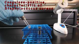 Coagulase Test for Staphylococcus [upl. by Huebner]