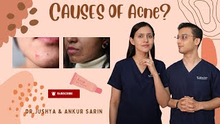 Cause of Acne  Root Causes of Acne  Acne के कारण  Dr Ankur amp Dr Jushya Bhatia [upl. by Ithnan]