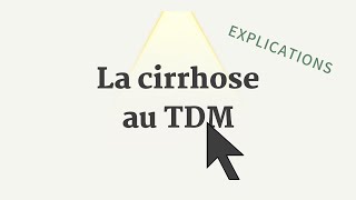 Cirrhose au TDM  Conf Apollon [upl. by Neladgam]