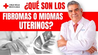 Miomas Fibromas qué son síntomas y tratamiento [upl. by Aivital]