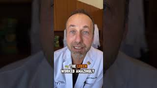 Yep leeches the slimy blood sucking ones shorts medicaltips medicaleducation [upl. by Necaj]