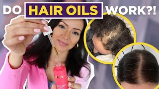 5 Best Oils for Healthy Hair  Oils for Hair Growth [upl. by Zorana]