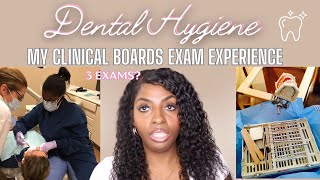 My Clinical Dental Hygiene Boards Exam Experience CDCAOSCE SinfulliAmbitiousss [upl. by Nwahsyar962]