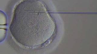 PICSI  human egg fertilization by selected spermatozoonAVI [upl. by Nasia]