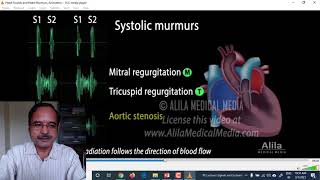 Lecture 13 Hearts Sounds Phonocardiography [upl. by Eberhart]