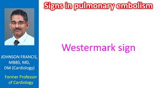 Signs in pulmonary embolism [upl. by Hennie]