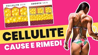 Cellulite Cause e Rimedi [upl. by Oinotnaocram]