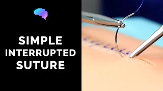 Simple interrupted suture wound suturing  OSCE Guide  UKMLA  CPSA [upl. by Eudoca]