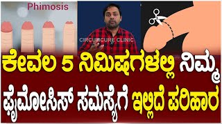 Circumcure Hospital Get A Best Treatment For Phimosis In Just 5 Minutes  Dr Kareddy Sridhar Reddy [upl. by Ermengarde]