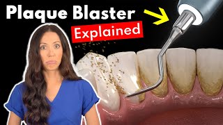 Dental Hygienist Explains Ultrasonic Scaling  Teeth Cleaning With Plaque Blaster [upl. by Anastasius]