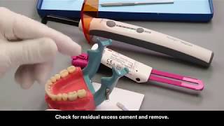 RelyX Lute 2 clicker cementation on a PFM crown [upl. by Nottage]