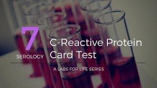 C Reactive Protein Card Test [upl. by Reisfield]