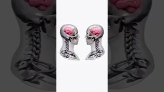 Where is our brain 🧠 shorts couple heartfeltmoments relatable ytshorts shortsfeed [upl. by Shelagh]