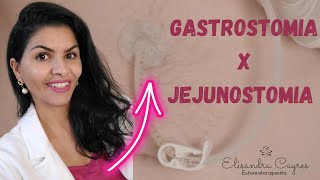 GASTROSTOMIA E JEJUNOSTOMIA VOCÊ SABE QUAL É A DIFERENÇA [upl. by Jere571]