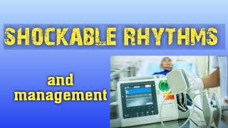 shockable rhythms and its management [upl. by Bard]