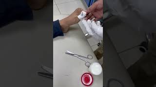 Demo20 Application of 40 Urea ointment to soften hyperkeratotic nail in Onychographosis [upl. by Suhpesoj]