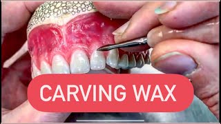 CARVING DENTURES IN WAX WAXBAE DENTURES [upl. by Notsla]