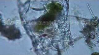 Brachionus patulus feeding Zooplankton Rotifer [upl. by Annod]